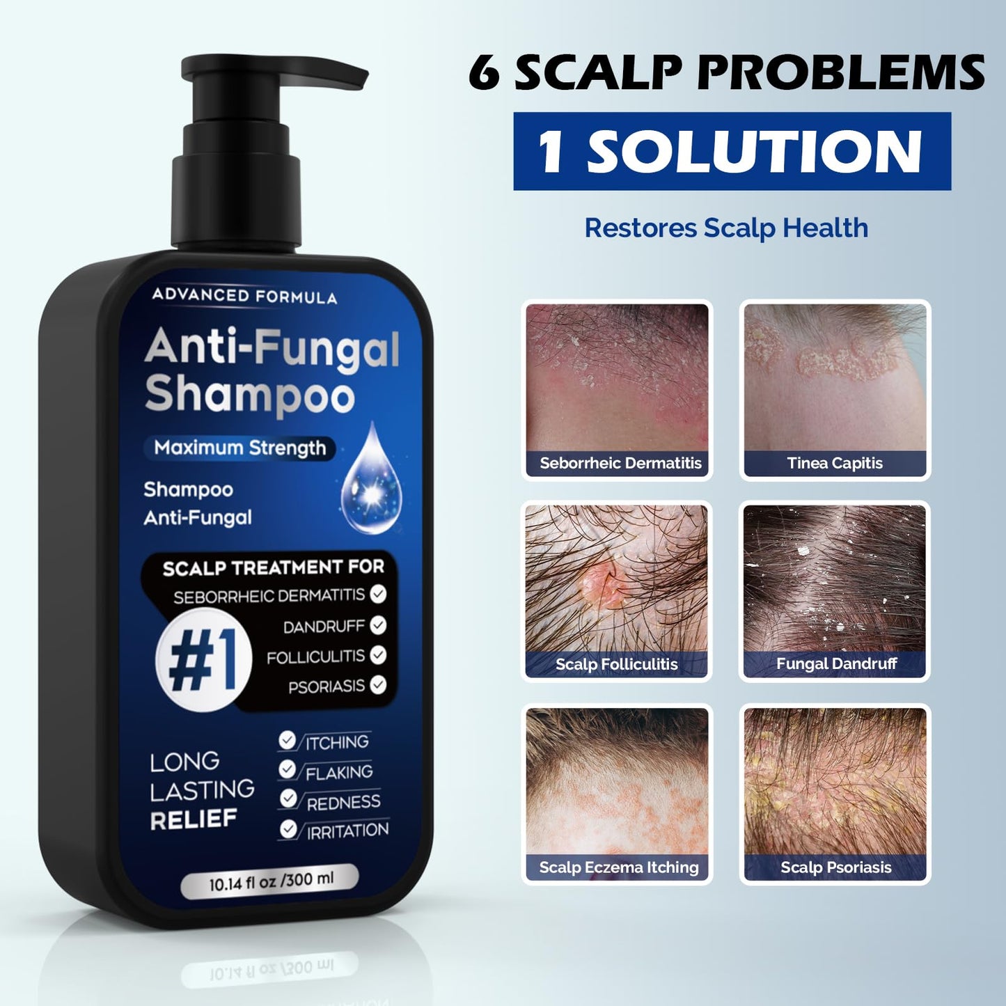 Antifungal Psoriasis Shampoo for Seborrheic Dermatitis, Folliculitis & Scalp Psoriasis, Anti-Dandruff Shampoo for Men & Women, Relieves Scalp Itching, Dryness, Sulfate & Paraben-Free, 10.1 Fl Oz-Fresh