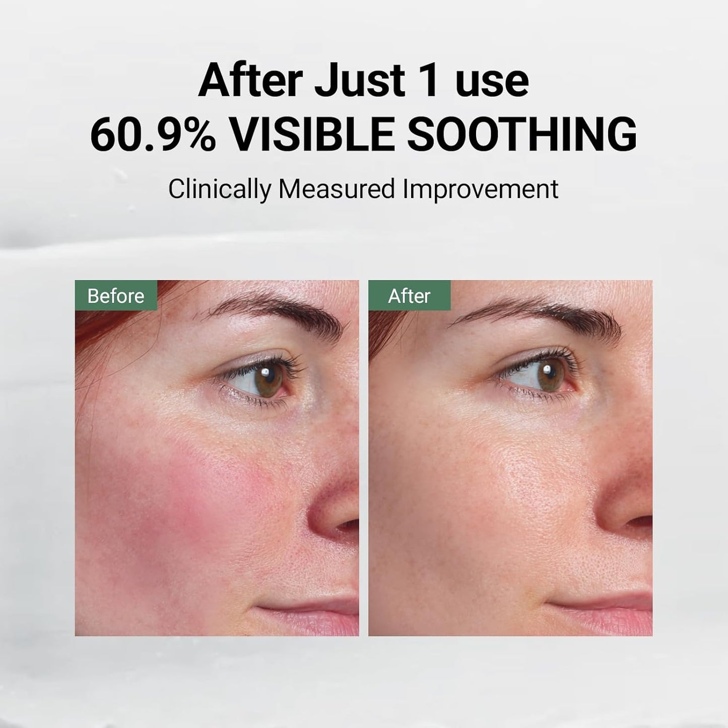 DA EFFECT Post Care Balm - Hydrating Barrier Repair for Sensitive Skin | Soothes Redness & Dryness, 30ml (Unscented)