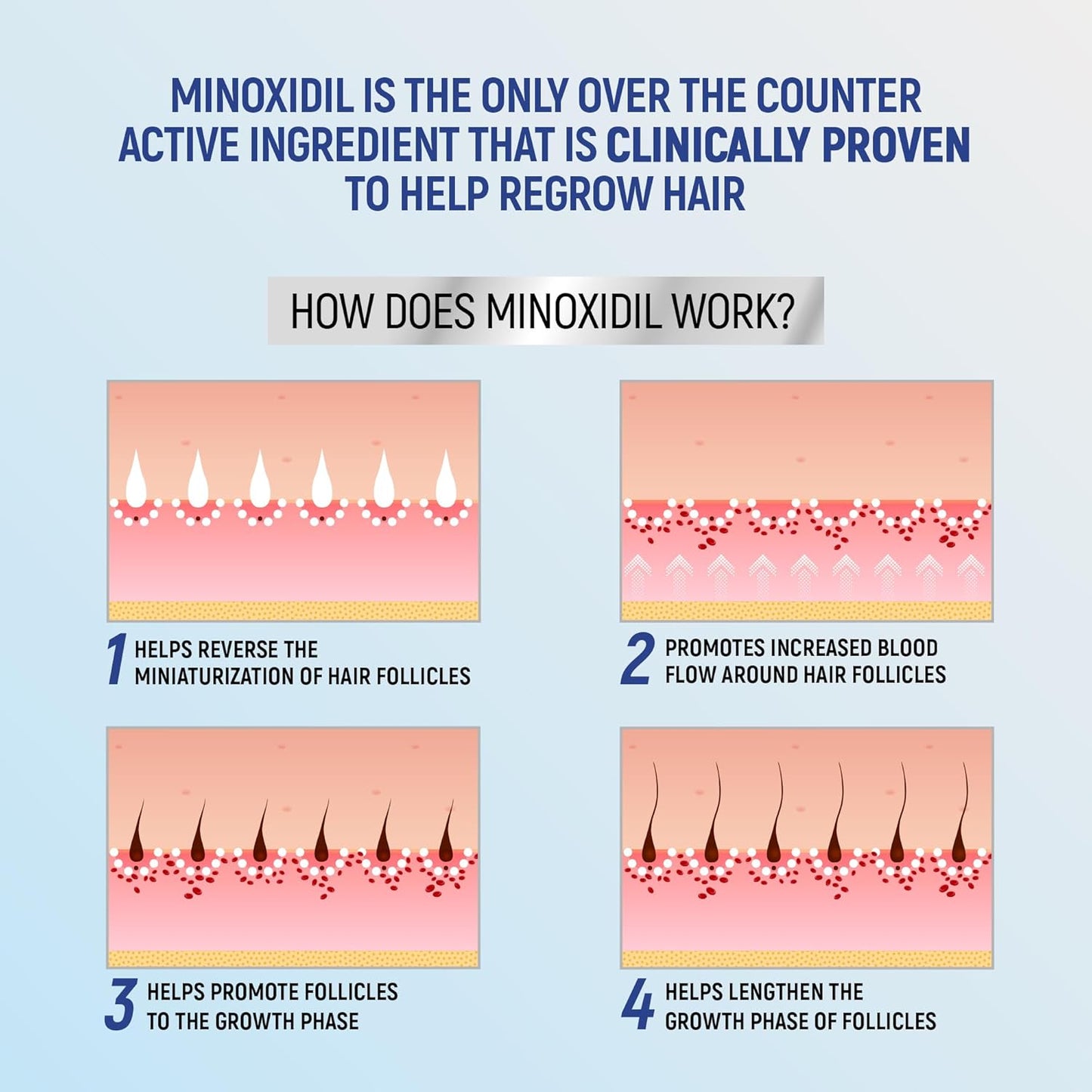 Minoxidil 5% Hair Regrowth Foam - 4-Month Treatment for Men | 2.11 oz (4 Pack)
