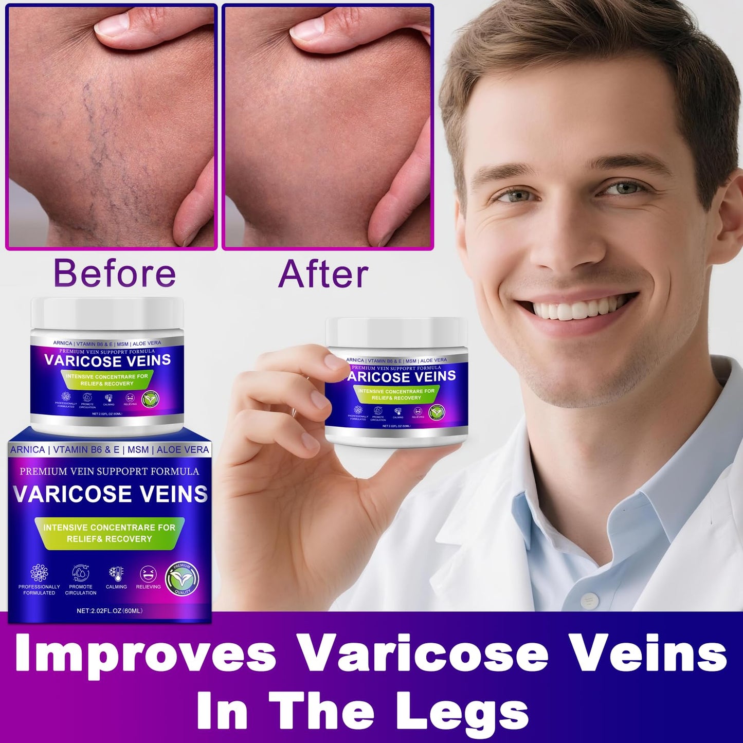 Yongsenina Varicose Veins Cream, Vein Cream & Spider Veins Treatment for Legs, Improves Blood Circulation and Relief From Heavy Fatigued Leg, Refreshing and Non-Sticky, 1Pack