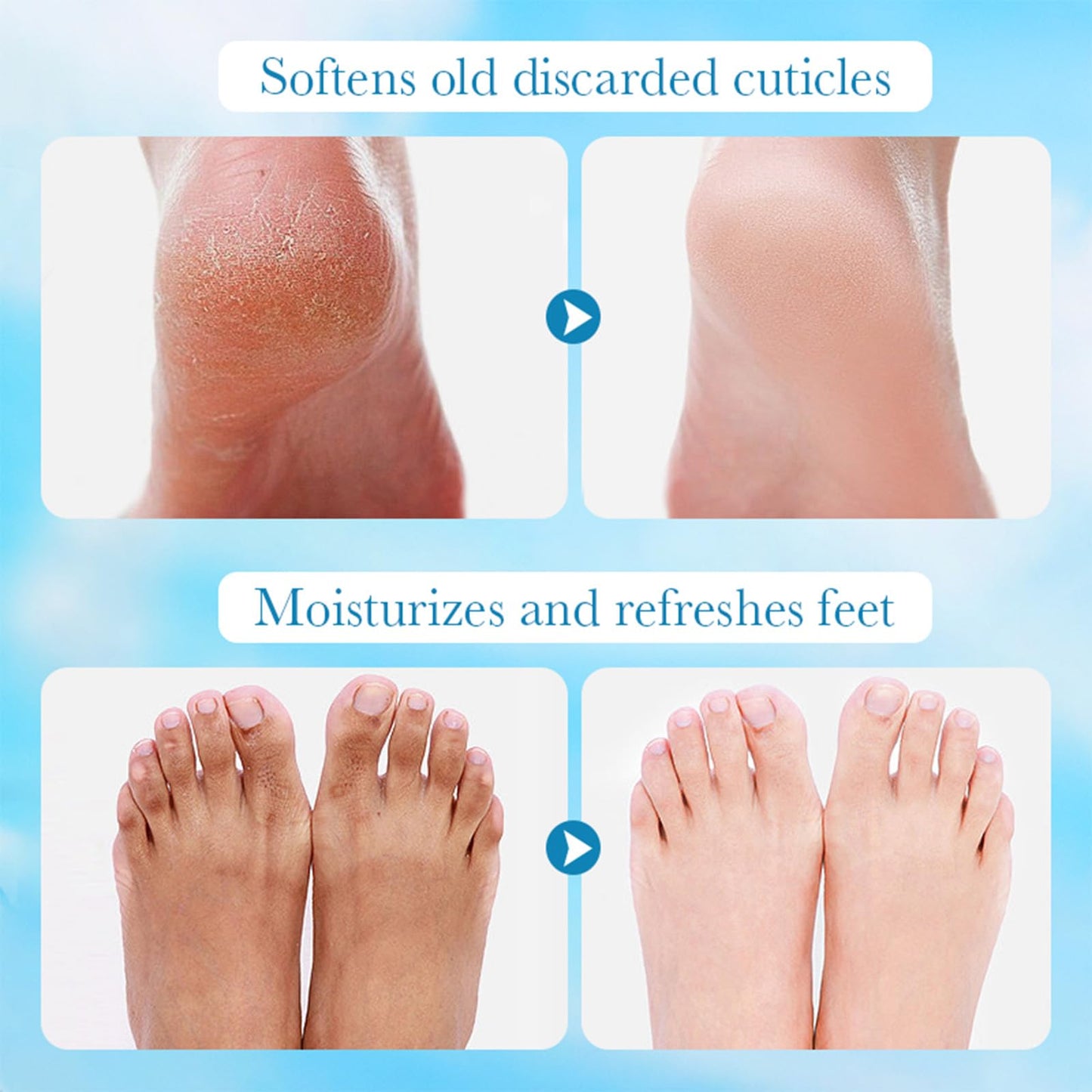 JoanofArc Moisturizing Foot Mask with Aloe Vera, Hydrating Foot Masks for Dry Cracked Feet, Foot Care Mask Skin Moisturizer for Soft and Smooth Touch Feet, Men Women, 4 Pairs