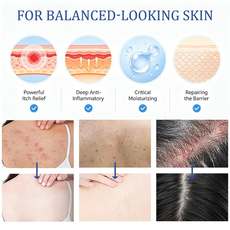 Folliculitis Care Cream for Body & Scalp - Formula for Razor Bumps, Ingrown Hairs & Skin Bumps on Face, Butt, Back - 120g (02)