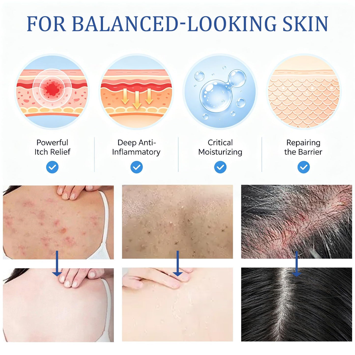 Folliculitis Care Cream for Body & Scalp - Formula for Razor Bumps, Ingrown Hairs & Skin Bumps on Face, Butt, Back - 120g (02)
