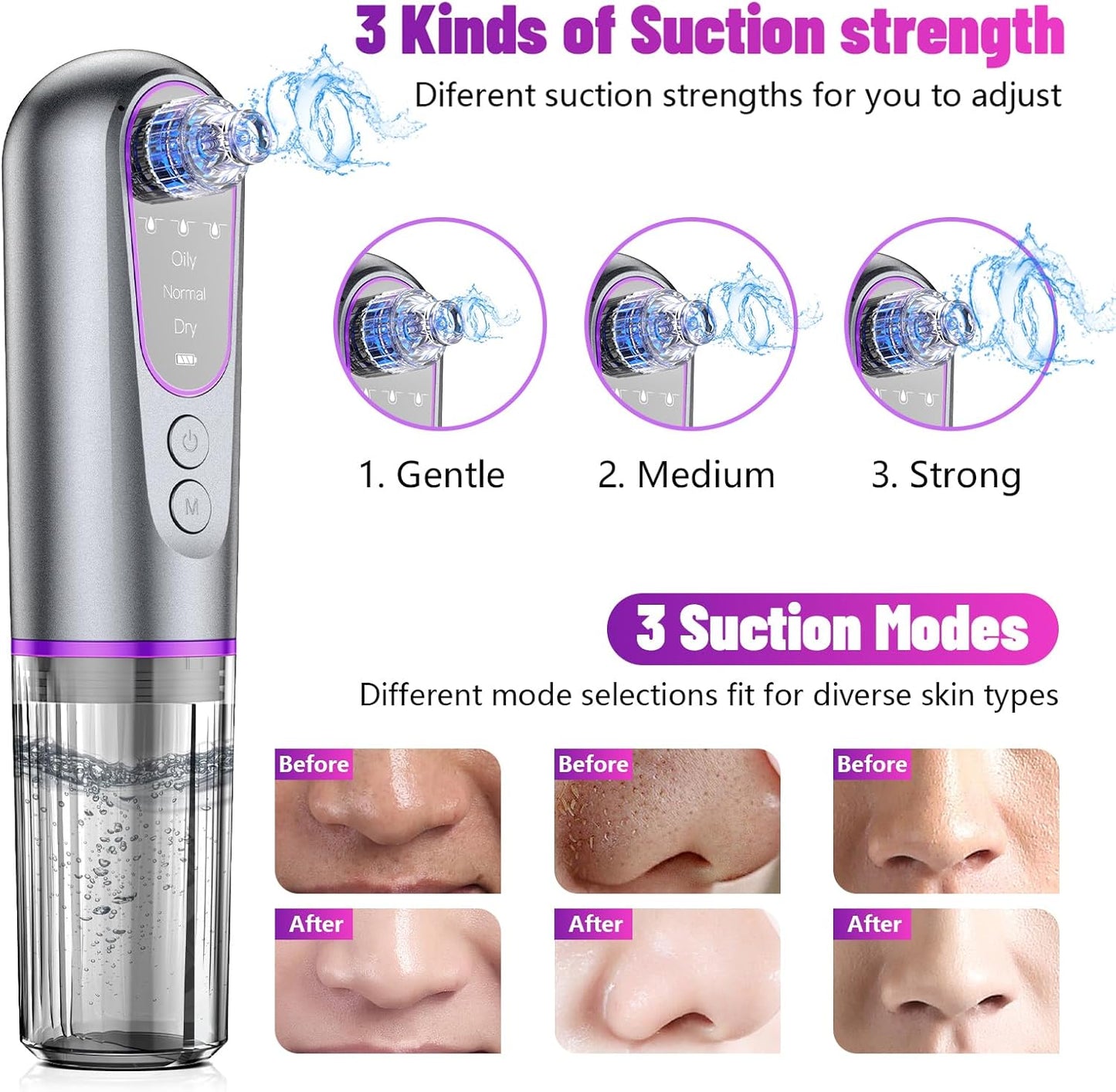 Blackhead Remover Vacuum - Facial Pore Extractor with 3 Suction Levels & 5 Heads for Deep Cleansing | Skin Care Tool