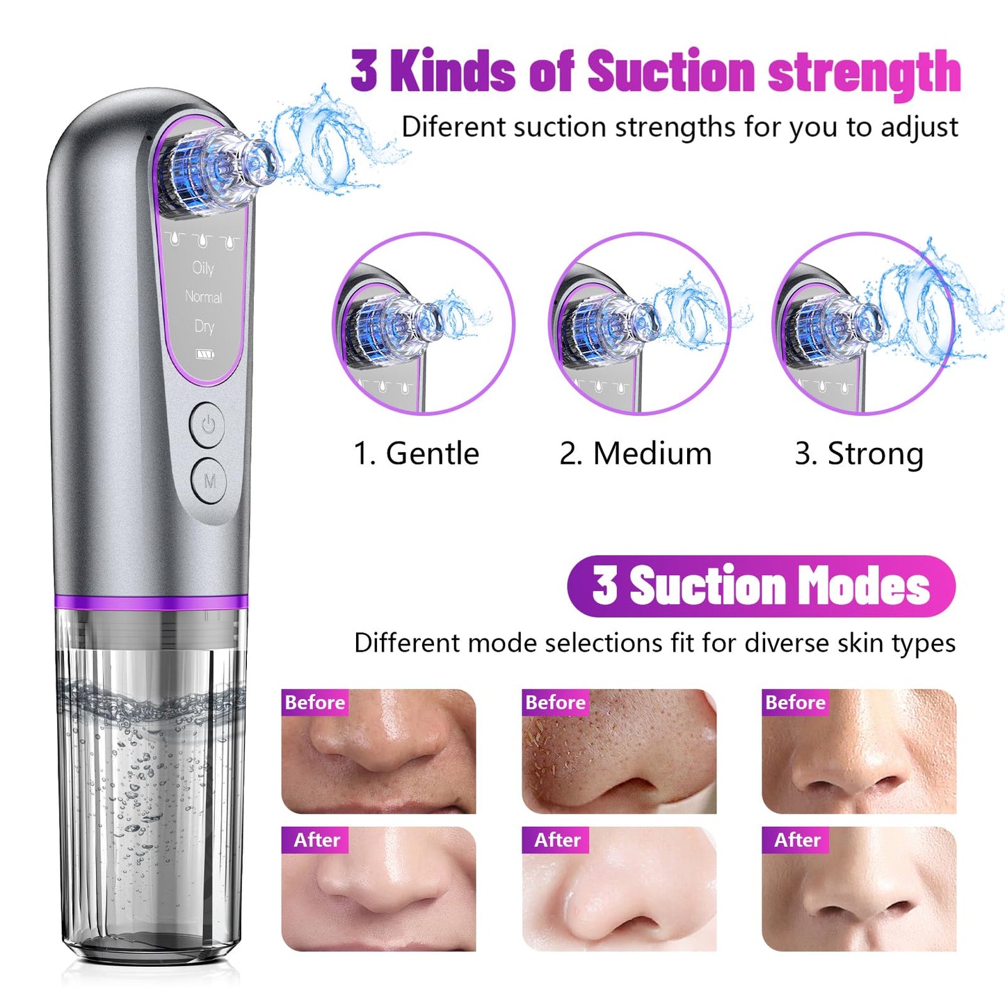 Blackhead Remover Vacuum with Microbubble Cleaning, Facial Pore Extractor & Pro Cleanser Tool, 3 Suction Levels, 5 Replaceable Heads for Deep Cleansing & Skin Care