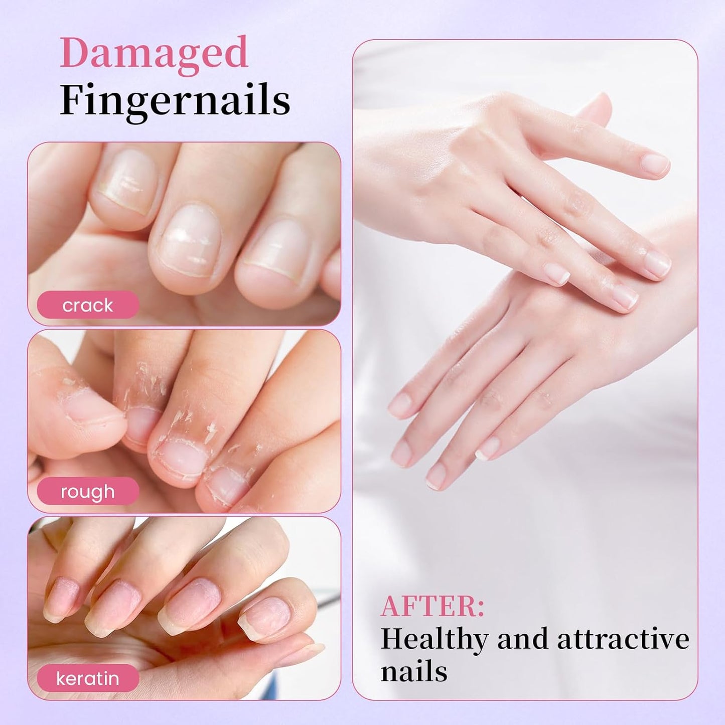 2-in-1 Cuticle Oil Pen - Ceramic Cuticle Pusher & Moisturizer for Damaged Nails | Nail Care Tool