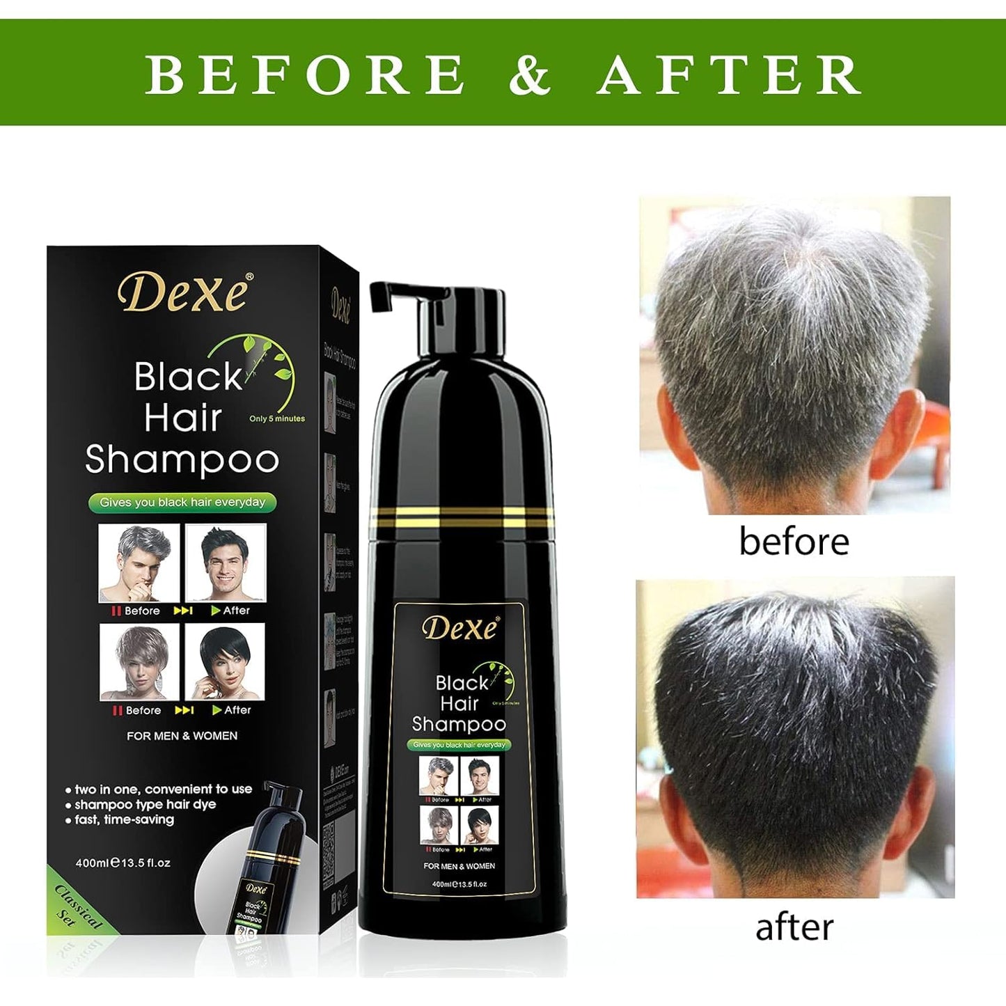 YUOLITA Brand 3-In-1 Black Hair Dye Shampoo, Herbal Ingredients, 100% Gray Coverage, Instant Hair Color Shampoo for Men Women, Natural Hair Lasts 30 Days, 400ML