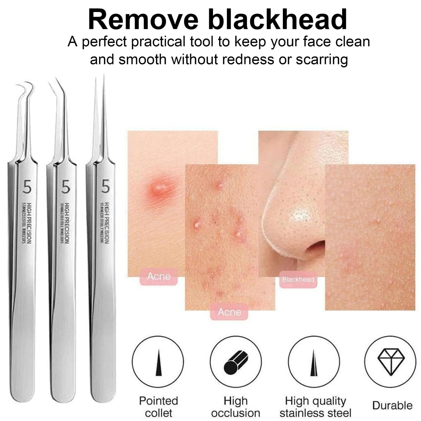 Professional Blackhead Remover Tweezers, Precision Pimple Popper Tool Kit, High-Hardness Stainless Steel Blackhead Extractor for Acne, Comedone, Whitehead, Facial Skin Care