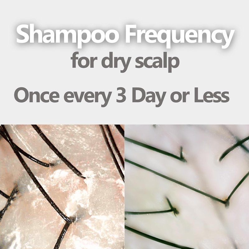 Aromase Dry Scalp Shampoo - Soothing Amino Acid Formula for Itch Relief - 14 oz
