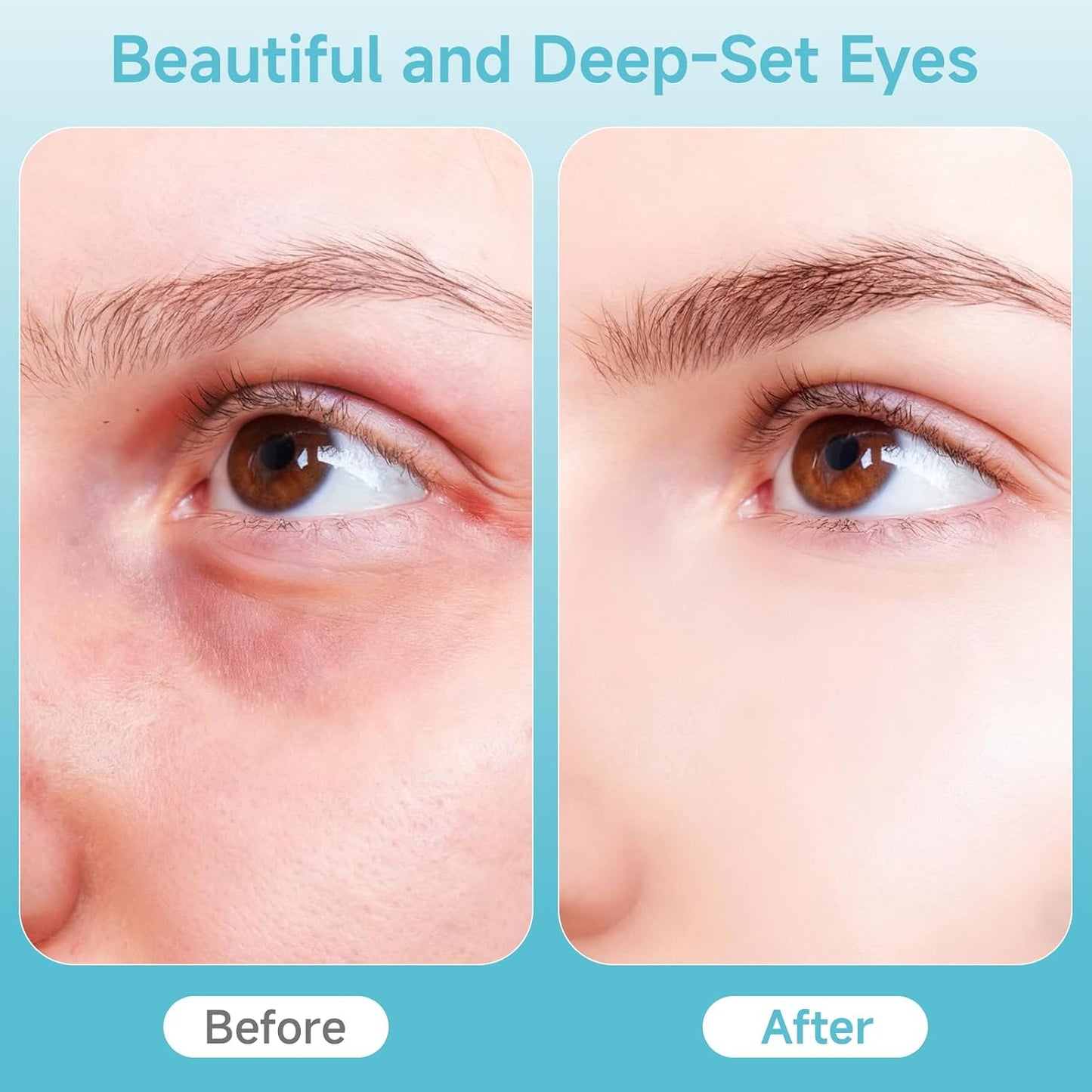 Depuffing Wand for Face & Eyes - 2-in-1 Cold & Heat Therapy | Adjustable Temp Beauty Tool for Puffiness & Dark Circles