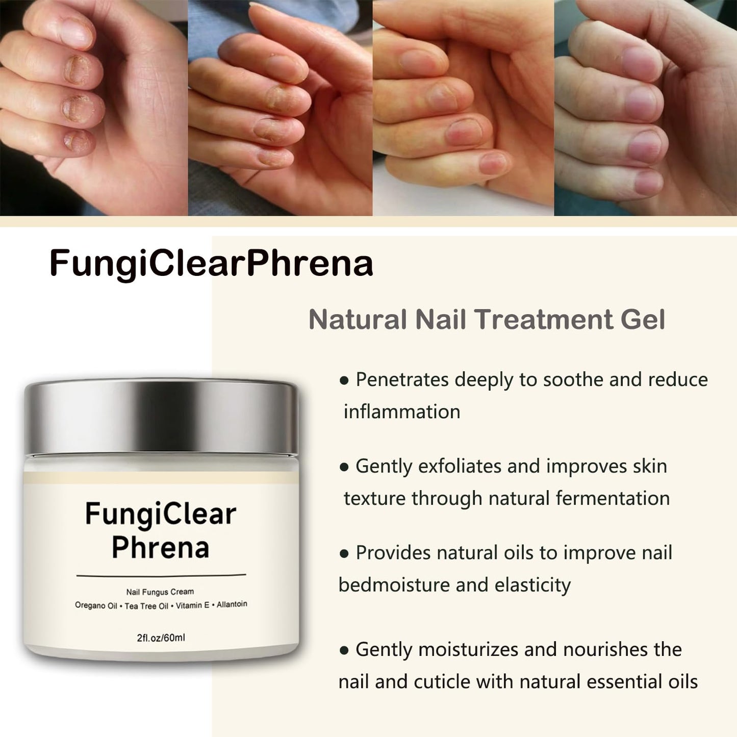 FungiClear Phrena Nail Care Cream,Toenail Nail Repair for Damaged, Strength & Nail Growth Tea Tree Oil, Oregano Oil, Vitamin E 60ml,2.03fl.oz (1pcs)