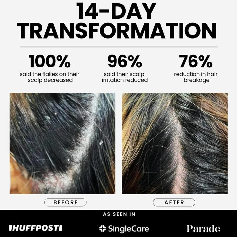 Anti-Dandruff Shampoo - Extra Strength 2% Pyrithione Zinc | Fragrance-Free, Color Safe, Sulfate Free Treatment for Flaky, Itchy Scalp