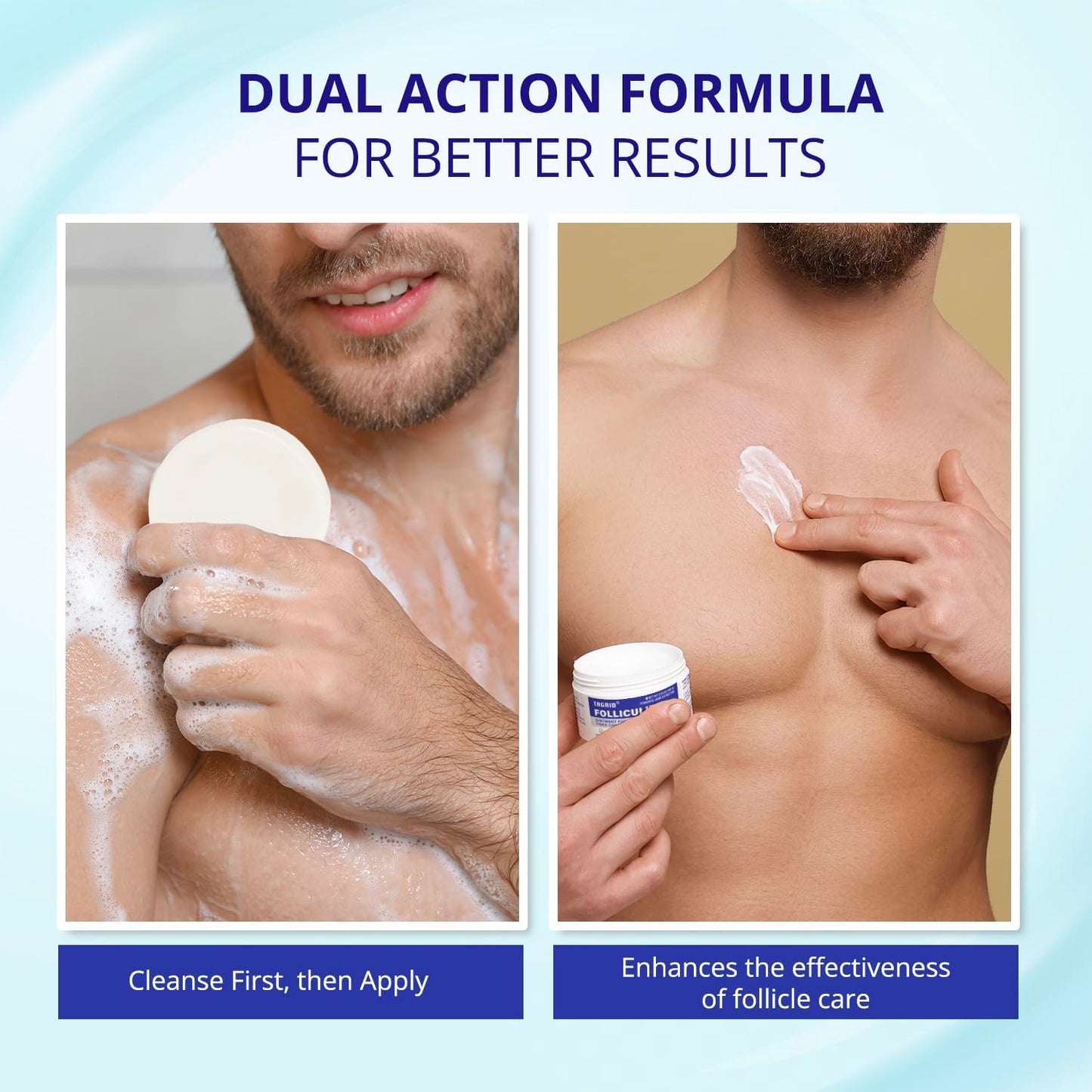 TAGRID Folliculitis Treatment Cream | Ingrown Hair Relief for Scalp, Face & Body - Hydrating & Soothing Formula