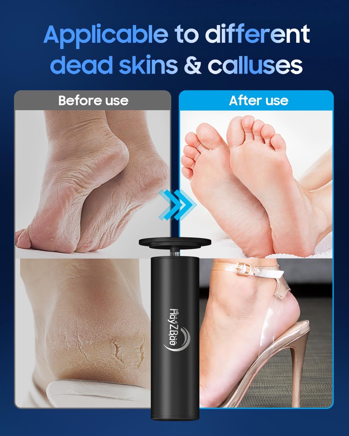 Electronic Foot File | Callus Remover for Effortless Dead Skin Removal - Includes 60 Sandpaper Discs for Smooth Skin