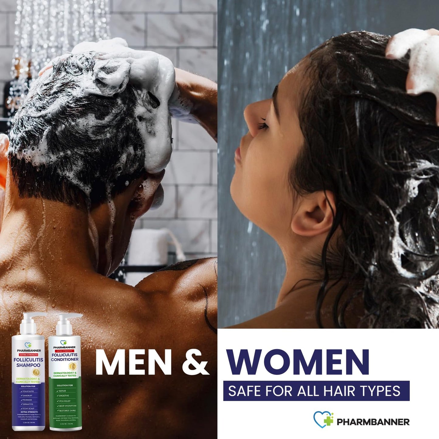 Anti-Fungal Shampoo & Conditioner Set - Tea Tree & Argan Oil for Folliculitis, Scalp Psoriasis | Relieves Itchy, Flaky Scalp
