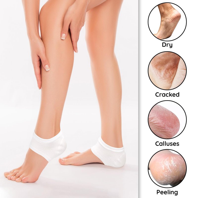 Segbeauty 16pcs Lotion Moisturizing Heel Socks, 8 Pairs Moisturizing Foot Socks Overnight for Cracked Heels Dry Feet, Toeless SPA Sleeping Sock for Men and Women Foot Care, Gel-Lined Sleep Socks Short