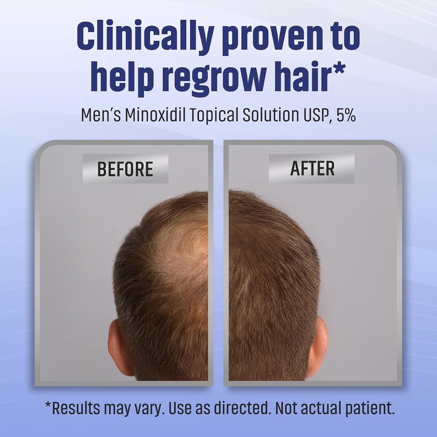 Minoxidil 5% Hair Regrowth Solution - Clinically Proven Tincture for Men | 2oz Bottle