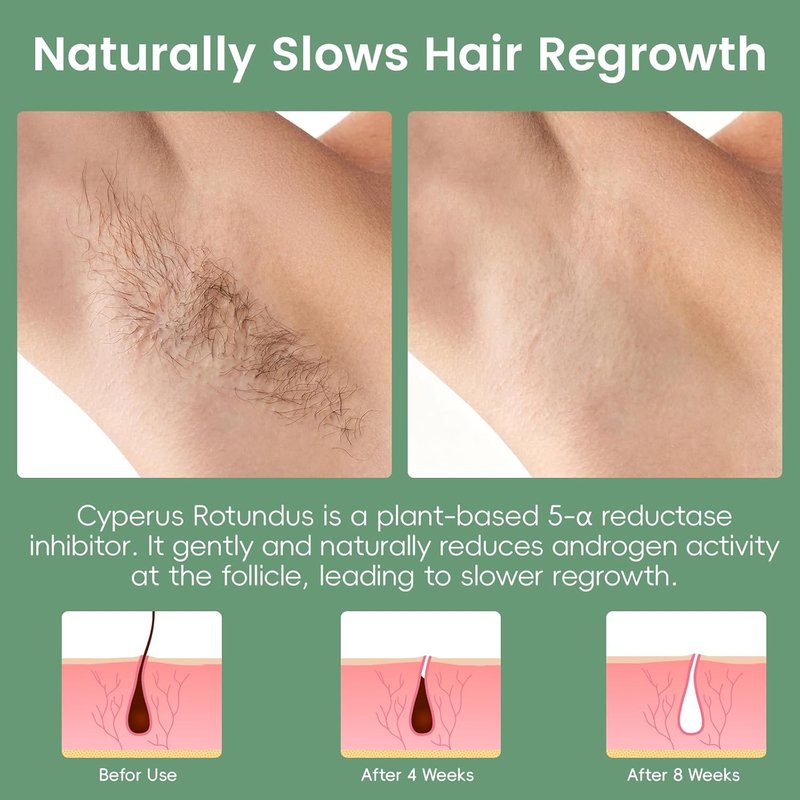 Cyperus Rotundus Oil Roll-On | Hair Growth Inhibitor & Skin Nourishing Serum - 2-Pack (2 x 1oz)