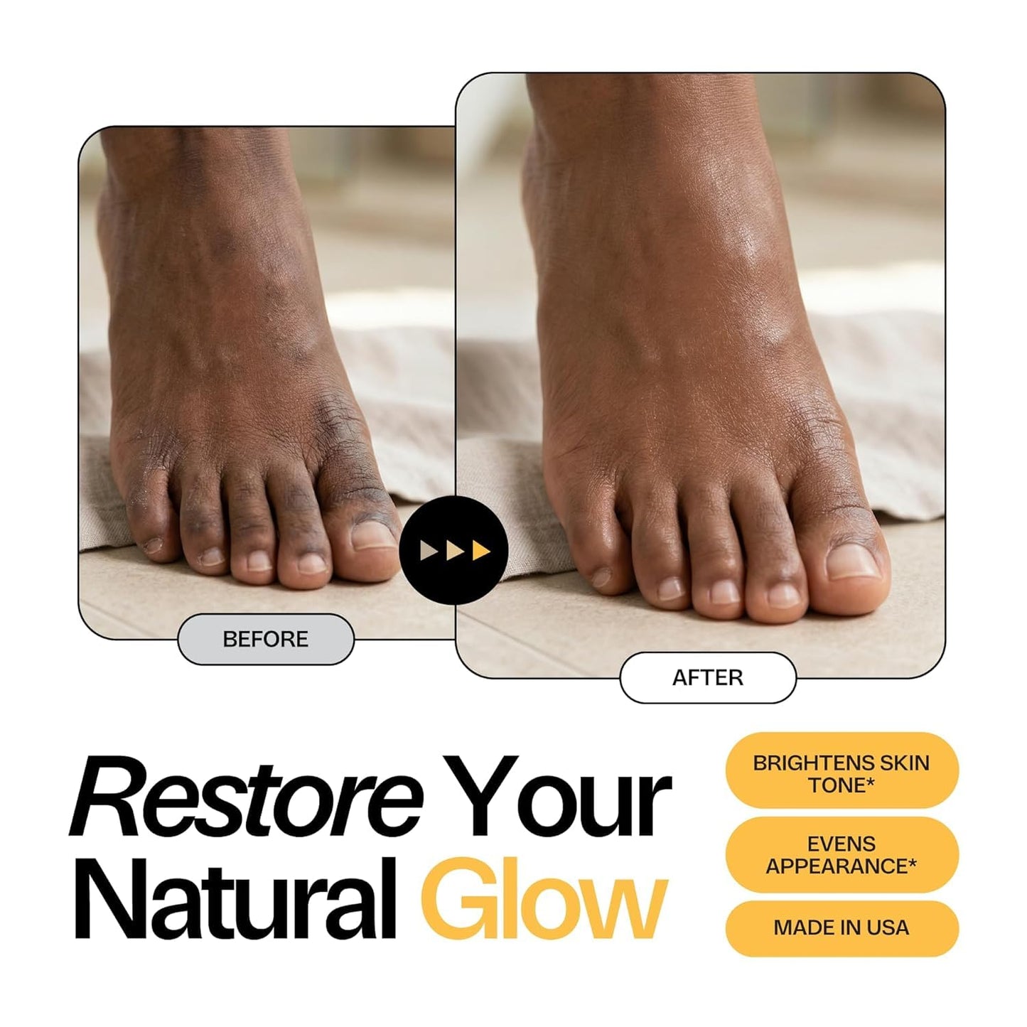 Foot Choice Skin Brightening Foot Soak with Kojic Acid & Niacinamide - Evens Skin Tone, Boosts Glow & Softens Calluses - Turmeric & Vitamin C - 2 Pack