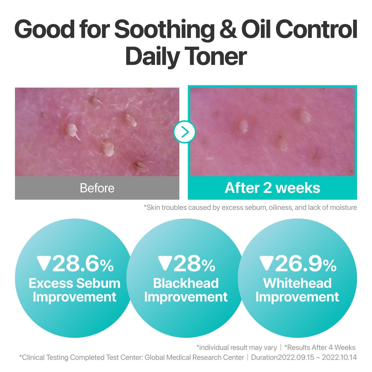 Numbuzin No.1 Toner - Calming Herb Formula for Breakouts & Redness | Centella Asiatica, Licorice Root | 10.14 fl. oz.