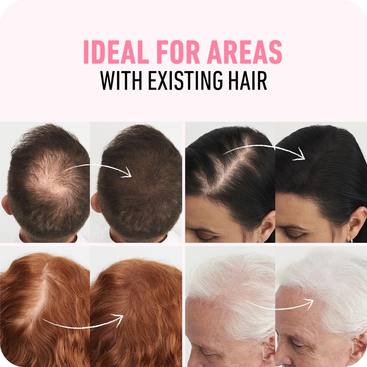 BOLDIFY Hair Fibers - Thinning Hair Solution for Instant Volume | 14 Shades Available - Dark Auburn (56g)