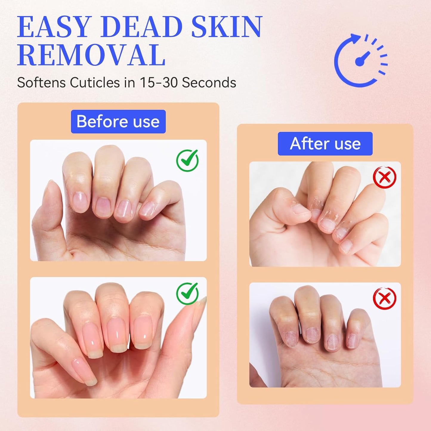 Cuticle Remover Oil Pen - Fragrance-Free Nail Care Gel for Moisturizing & Strengthening Dry Cuticles | Portable Beige Pen