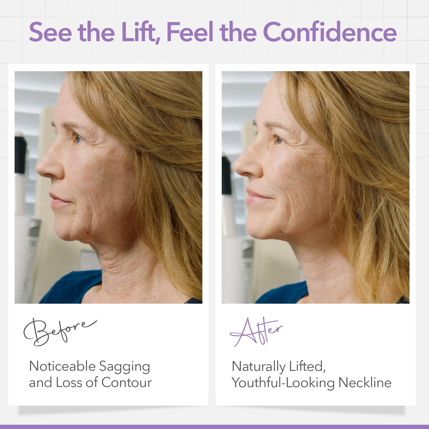 NECK LESS Professional Face Lift Strips – Instant Jawline & Neck Lift Tape | Medical-Grade, Invisible, Waterproof Skin-Tightening Solution | Non-Surgical Facial Tape Kit, 10-Hour Hold (25 Strips)