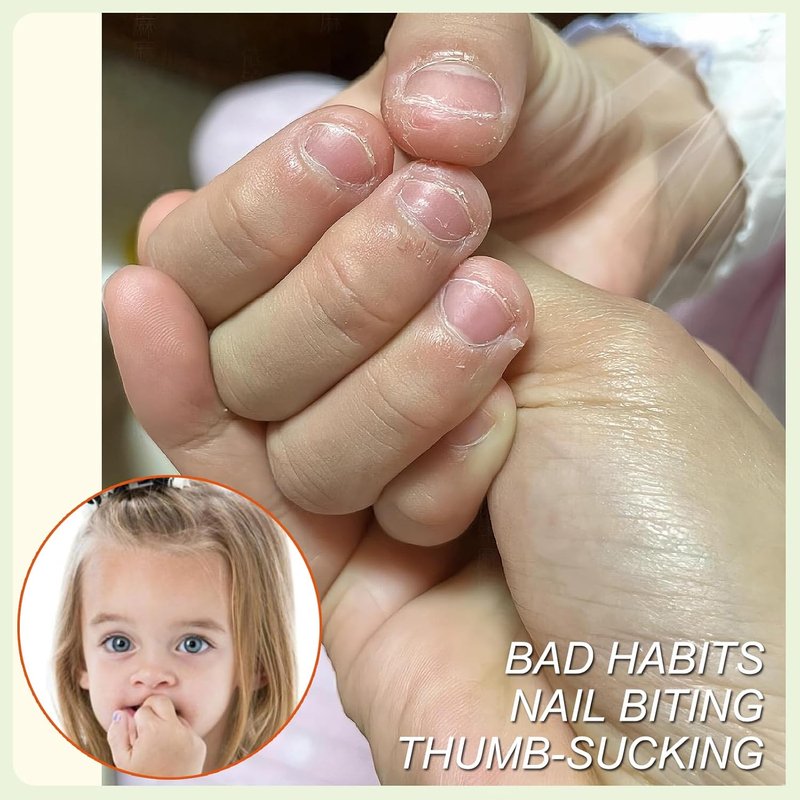 Nail Biting Treatment for Kids - Effective Solution to Stop Thumb Sucking | Safe, Non-Toxic Formula