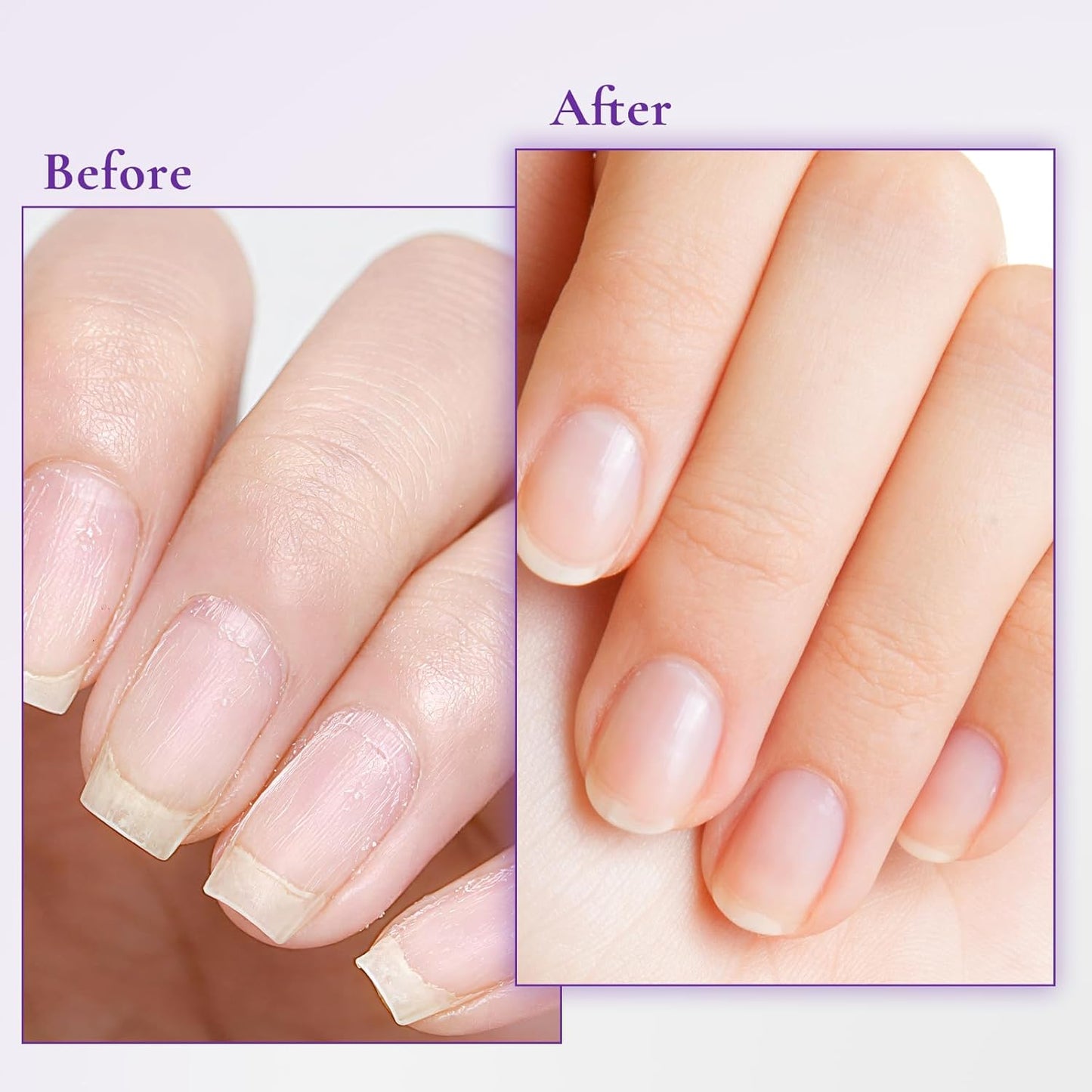 Nail & Cuticle Cream - Keratin, Biotin & Ceramides for Deep Hydration | Strengthens Nails & Softens Cuticles, 15ml (Pack of 2)