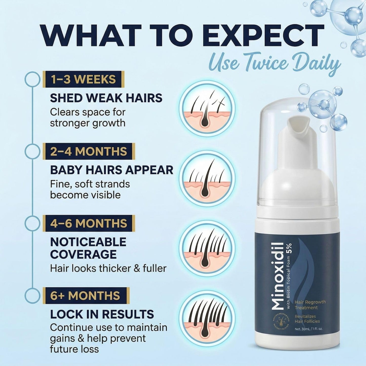 5% Minoxidil Foam for Men and Women: 2-Pack Travel Size 1oz Cans - Topical Hair Regrowth Treatment & Follicle Reactivator for Thinning Hair - Fast-Absorbing Recovery Kit - 1 Month Supply