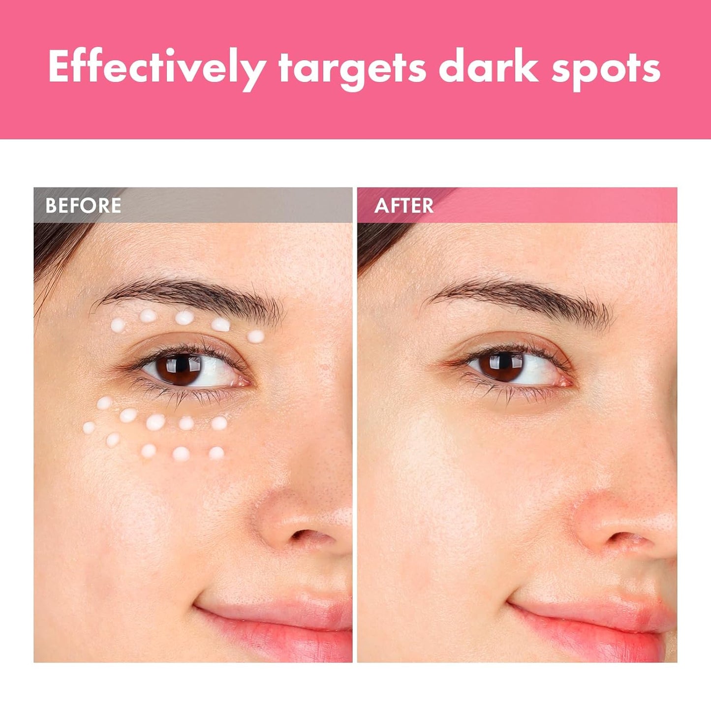 Arbutin 7% Intensive Spot Cream - Dark Spot Treatment with Tranexamic Acid & Niacinamide | 20ml
