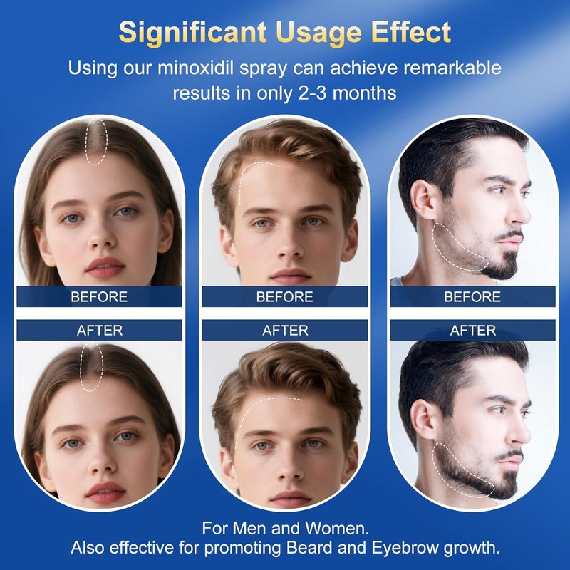 Minoxidil Hair Growth Serum for Men & Women - Extra Strength with Biotin | 6-Month Supply 4-Pack (14 fl oz)