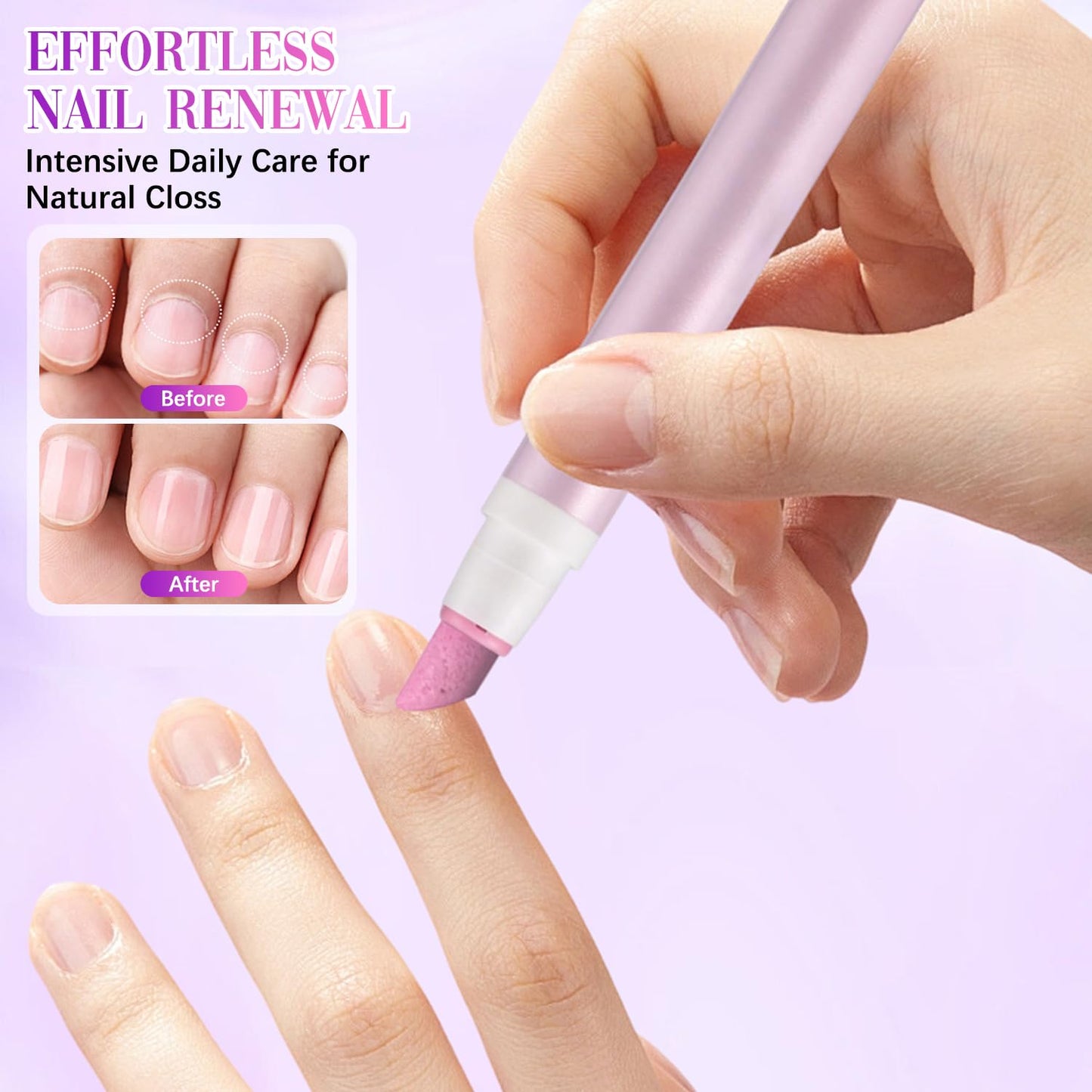 Cuticle Oil Pen Set - 2-in-1 Moisturizer & Ceramic Pusher | Portable Nail Care Tool, Mixed Colors