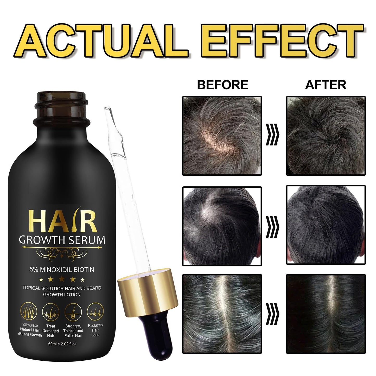 5% Minoxidil Hair Growth Serum for Men & Women - for Stronger Thicker Longer, Hair Regrowth Treatment- 2.02 oz