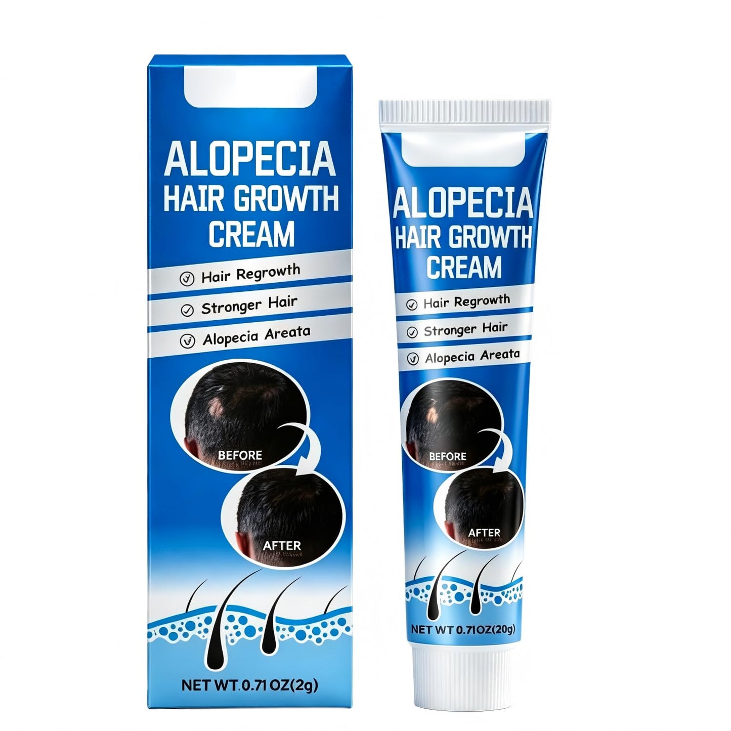 Alopecia Hair Growth Cream with Biotin & Rosemary Oil | Anti Hair Loss Treatment for Thicker Fuller Hair, Scalp Nourishing Butter for Thinning Hair, Intensive Hair Densifying Essence for Men & Women