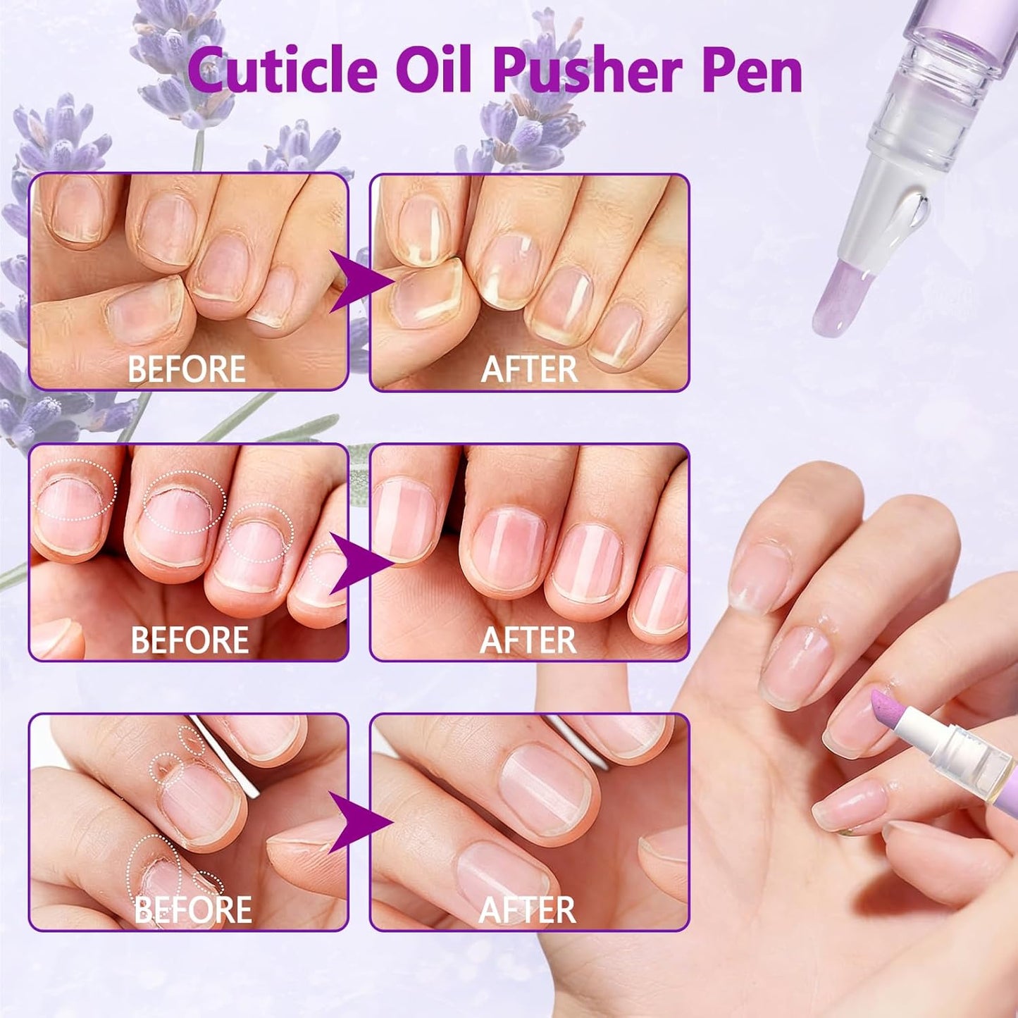 2-in-1 Ceramic Cuticle Oil Pusher Pen - Moisturizing Nail Care for Dry & Damaged Nails | 2PCS
