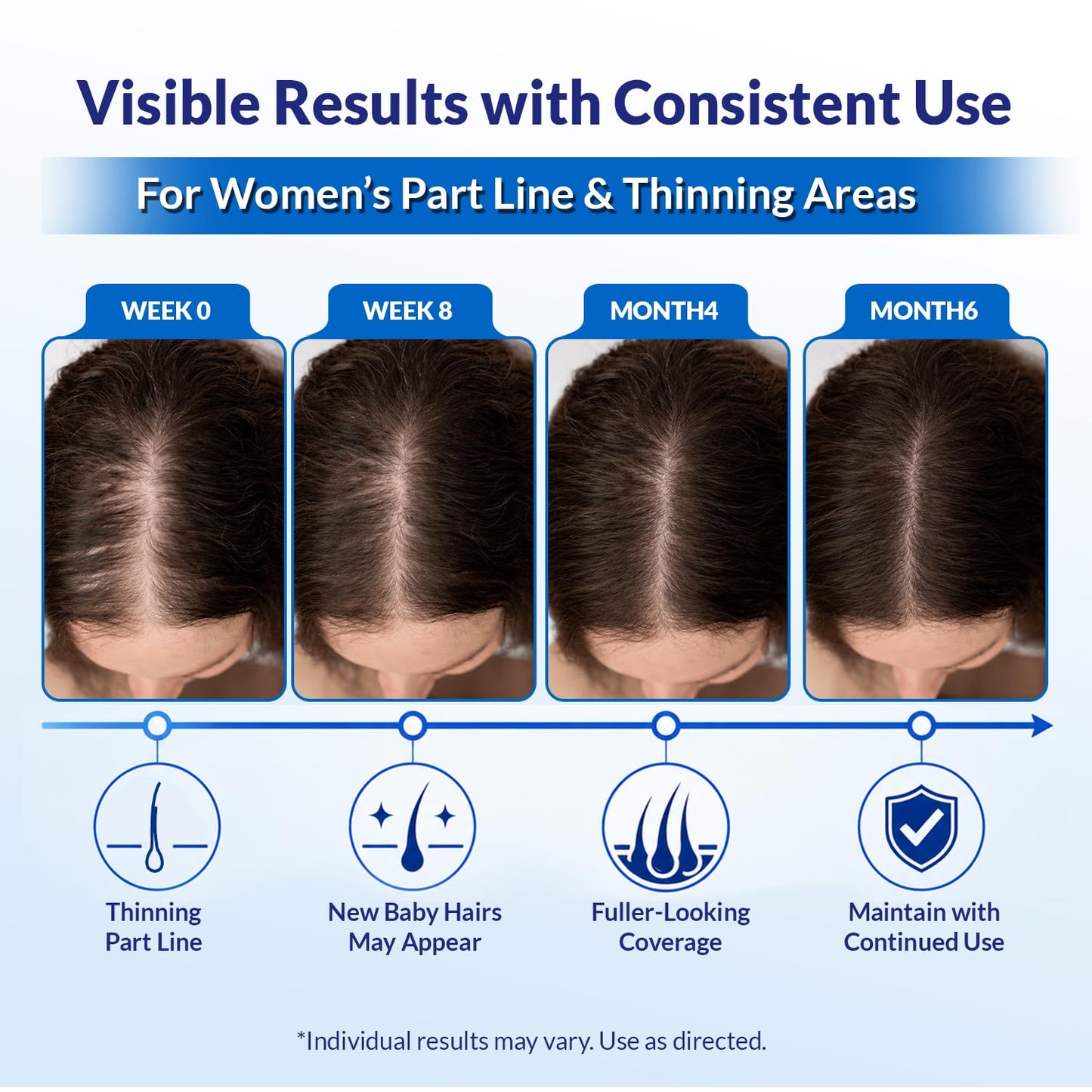 Minoxidil for Men and Women Extra Strength: Minoxidil 5% Topical Solution for Hair Regrowth Treatment for Hair Loss & Thinning Hair - Liquid Formula with Dropper Applicator