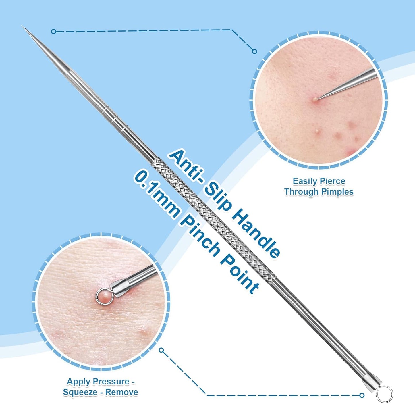 Stainless Steel Blackhead Remover Kit - Surgical Grade Pimple Extractor Tool | 2-Piece Set for Face & T-Zone