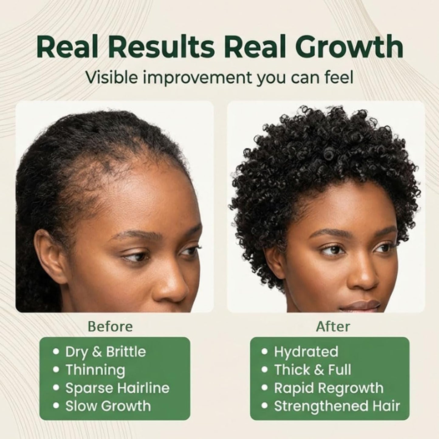 Yicengy 2Pcs Oil for Hair Growth, 100% Pure Organic Batana From Honduras, Scalp Oil Promotes Hair Thickness, Effective Hair Care With Promotes Hair Thickness & Good Texture for Men & Women