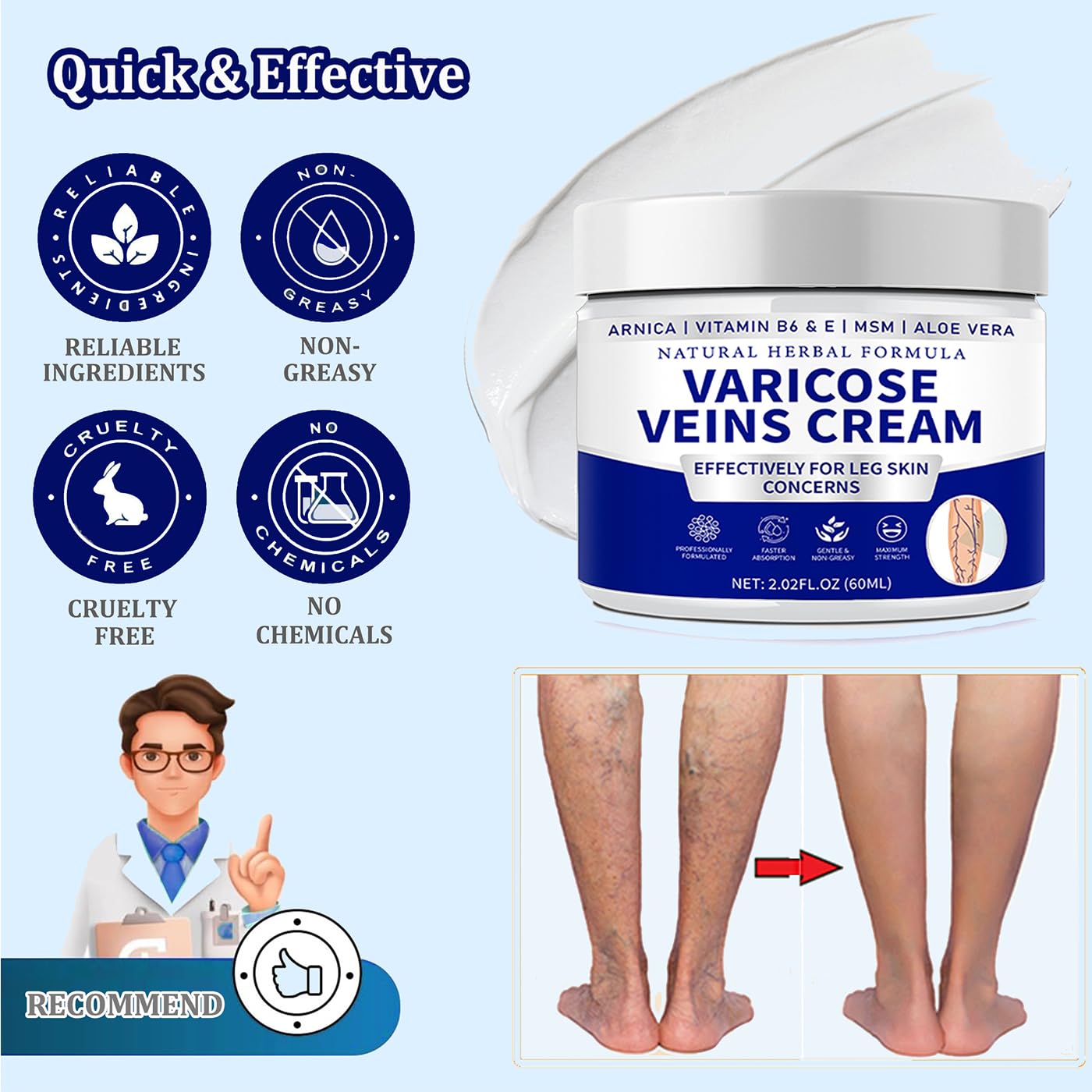 Varicose Veins Cream for Legs - Natural Spider Vein Treatment for Women & Men | Gentle Formula