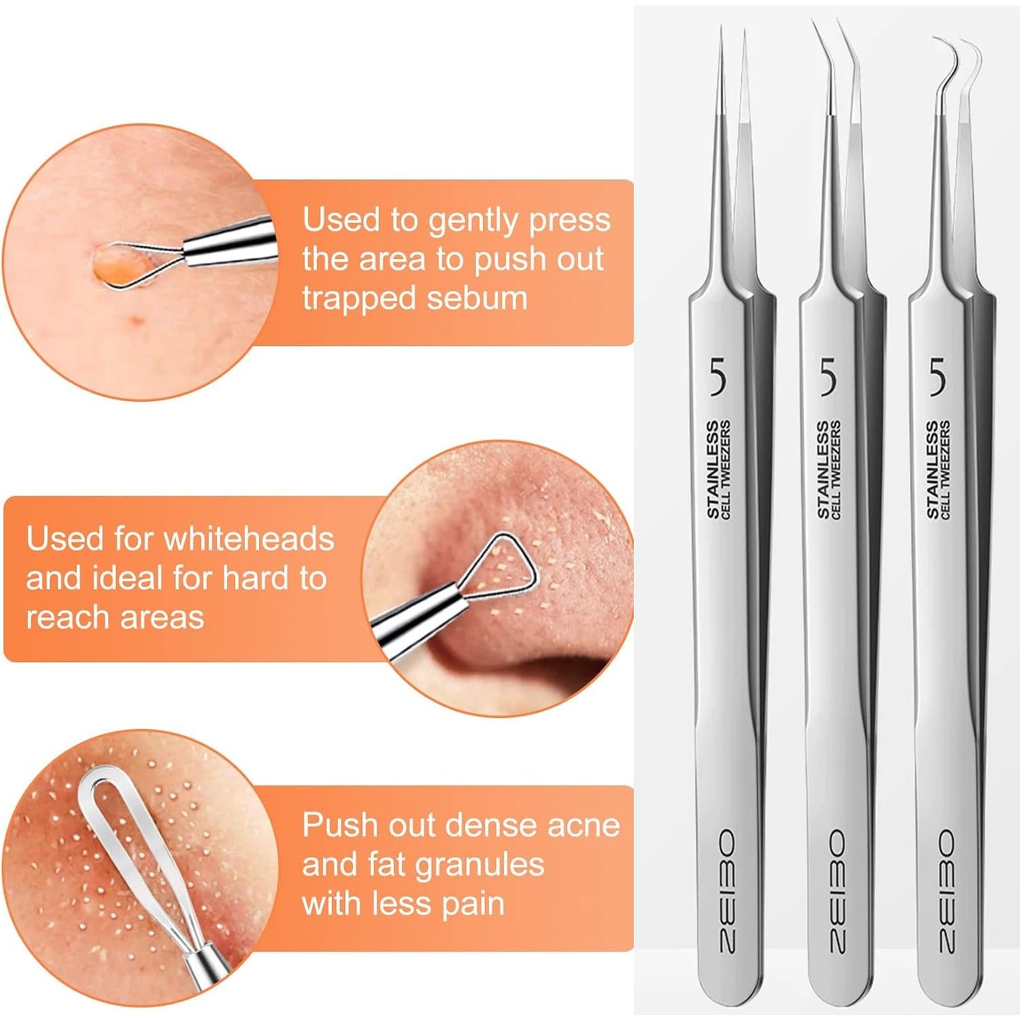 Blackhead & Acne Removal Tool Set 3PCS Professional Stainless Steel Blackhead Tweezers, Extractor for Removing Pimples and Acne on Face