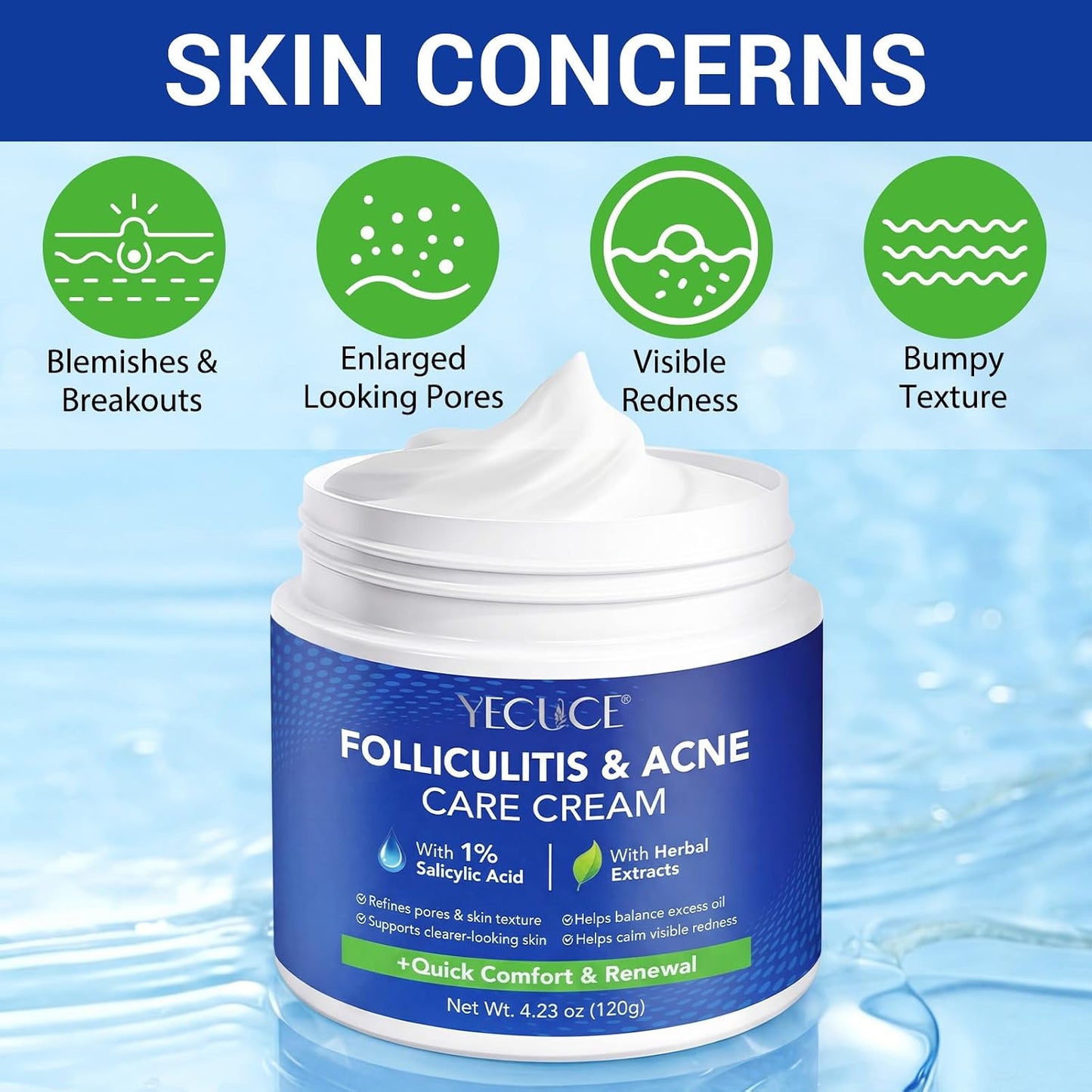 Folliculitis & Acne Cream - Hydrating Formula for Scalp, Face, Body & Butt | Soothes Irritated Skin, 120g
