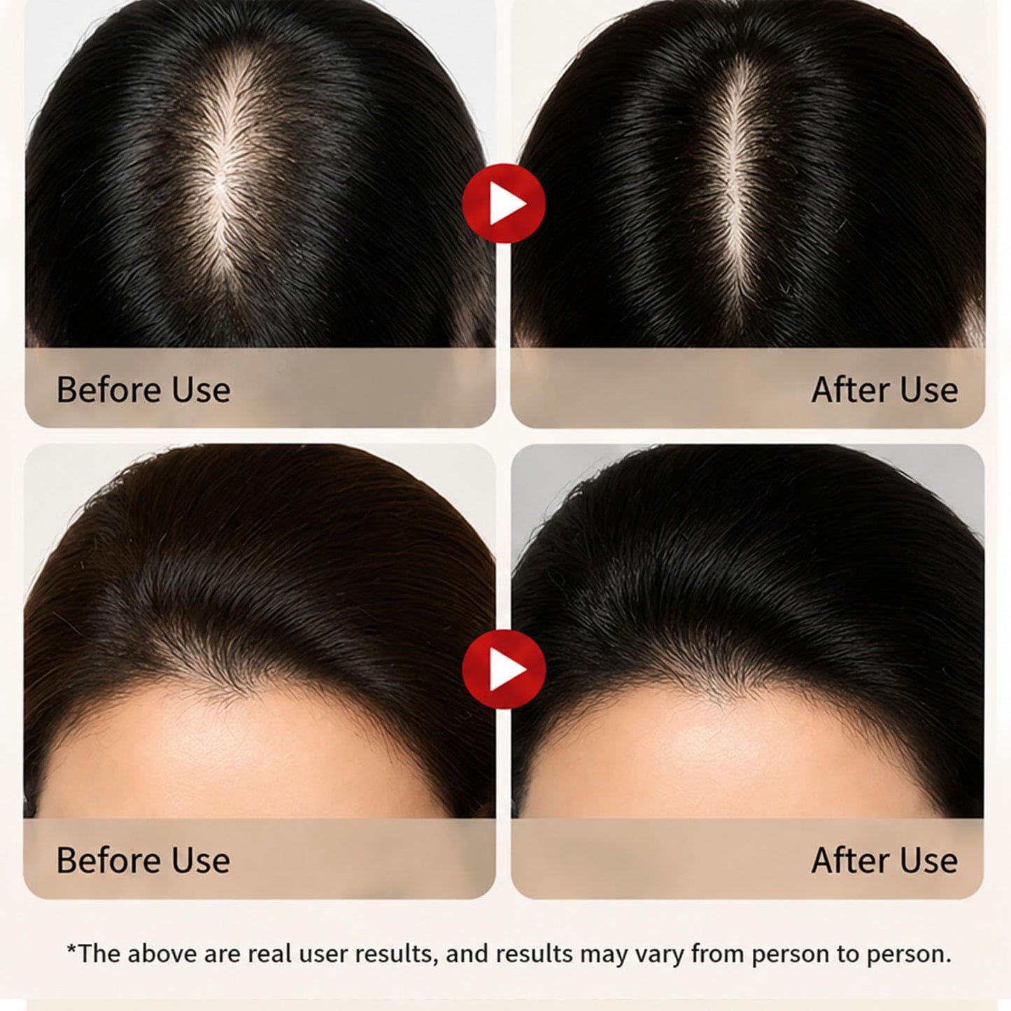Luna Miracle Hair Growth Oil, Hair Growth Serum, Natural Hair Density Essential Oil, Strengthening Oil Infused Frizzy & Damaged Hair Care to Support Longer, Healthier Strands (2PCS)