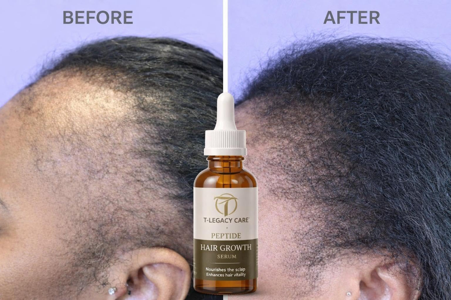 Hair Growth Serum for Women & Men, Hydrating Scalp Treatment for Thicker Stronger Looking Hair, 30ml