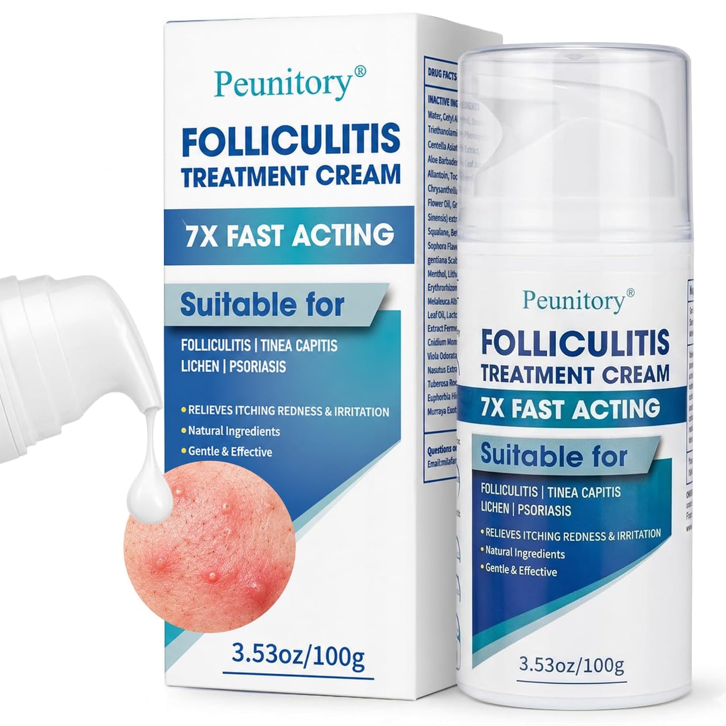 Folliculitis Treatment Cream - 5% Benzoyl Peroxide for Scalp & Body Bumps | Fast Relief for Itching & Redness, 3.53 oz