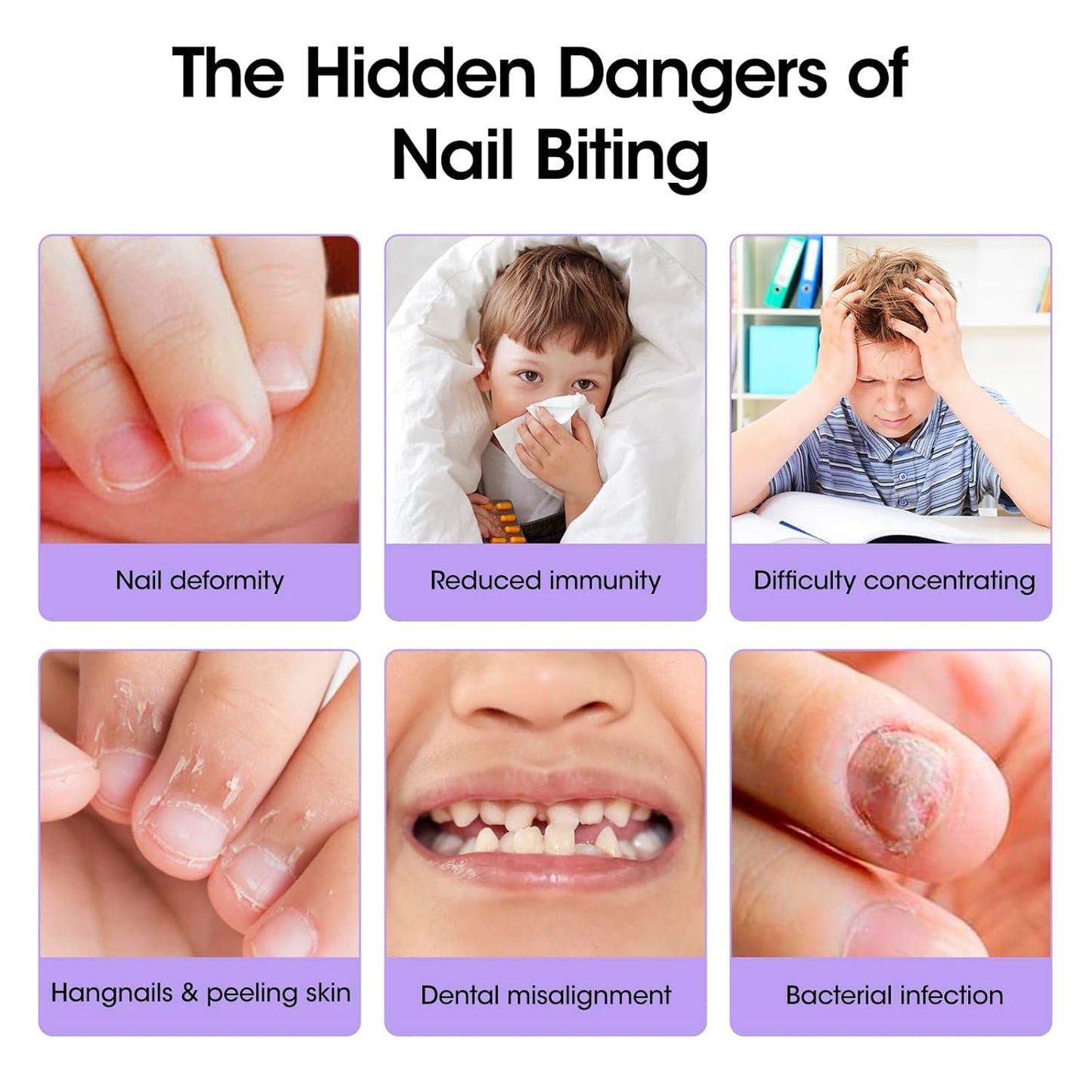 Gellen Nail Biting Treatment - 15ml Bitter Taste Solution for Kids & Adults | Stop Nail Biting & Thumb Sucking