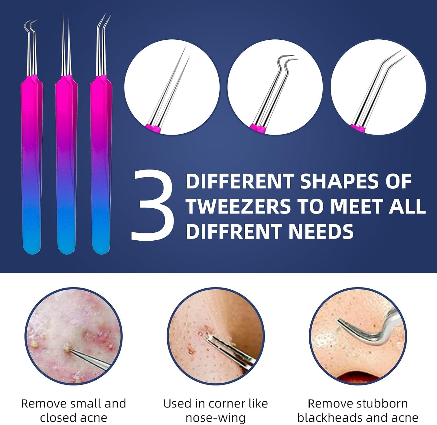 Pimple Popper Tool Kit - 10-Piece Blackhead Remover Set with Metal Case for Easy Comedone Extraction | Colorful