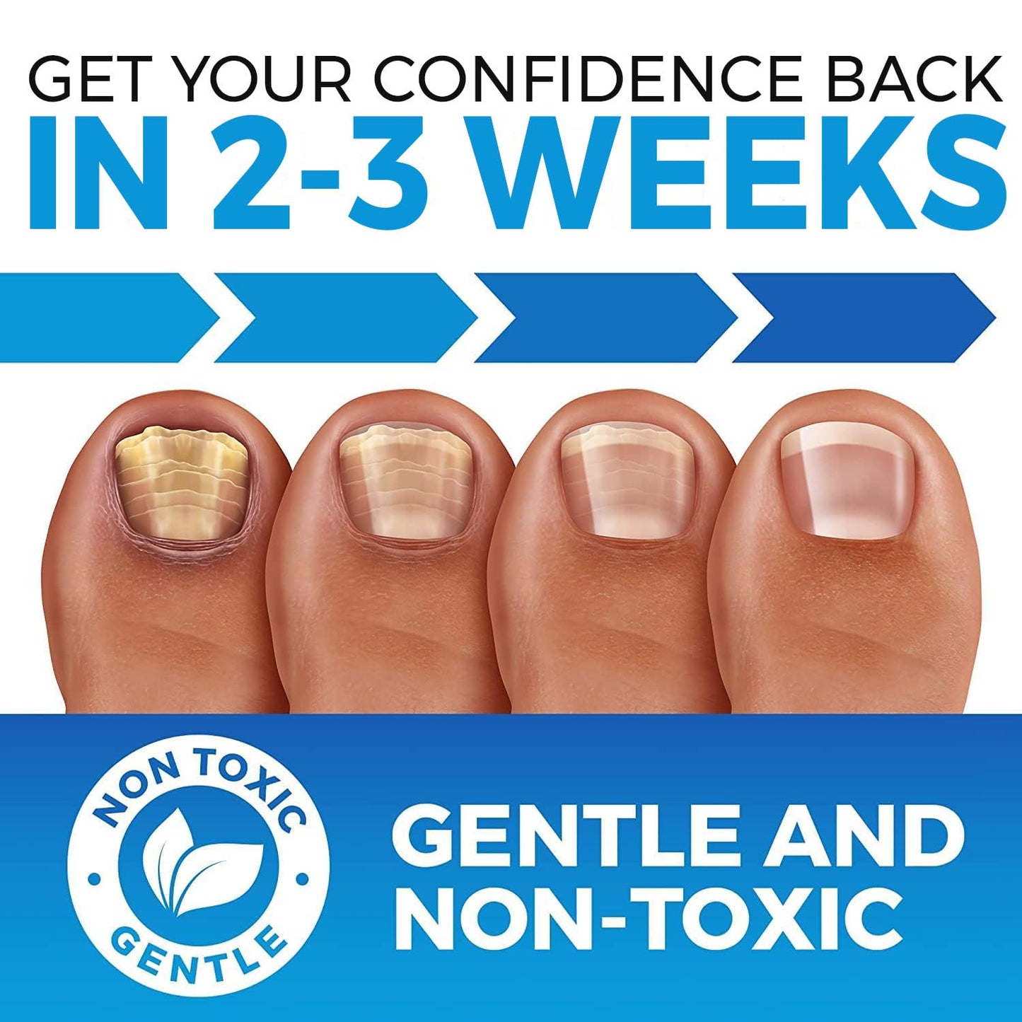 Toenail Fungus Treatment Extra Strength (FDA REGISTERED) - Fungi Nail Fungus Cream - XL - Nail Strengthener and Growth Improved Formula (Made in USA) 2.54 Fl oz