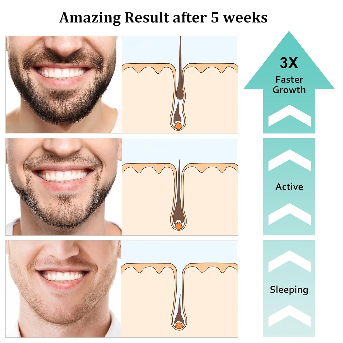 Beard Growth Kit - 2oz Beard Growth Oil with Biotin & Castor Oil for Fuller, Thicker Beard | Perfect Gift for Men