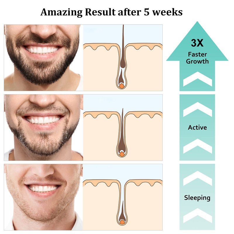 RAFFIN Beard Growth Kit, Beard Growth Oil (2Oz) w/3 X Thickening Biotin & Castor Oil for Spot/Patchy Beard, Achieve Fuller, Thicker, Healthier Beard, Birthday Gifts for Men Him Boyfriend Husband Dad